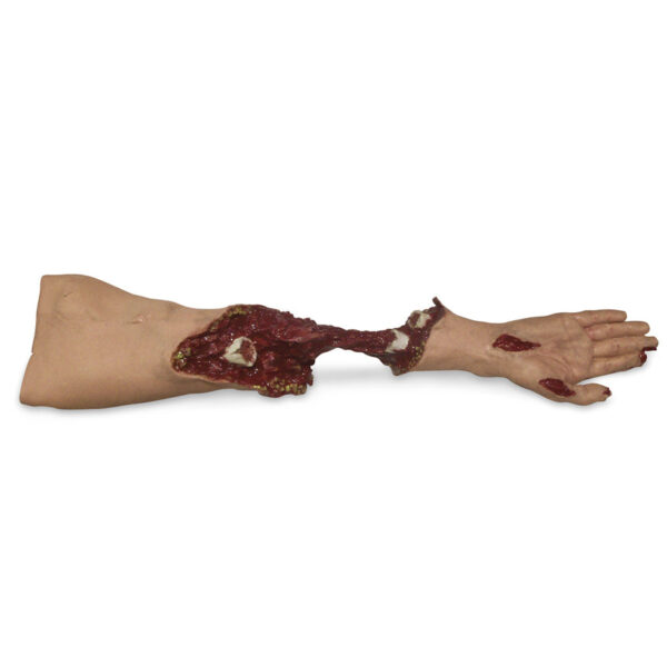 Nasco Xtreme Trauma Moulage Arm