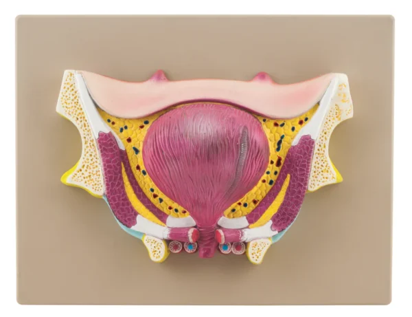 Eisco Scientific Bladder Pathology Model