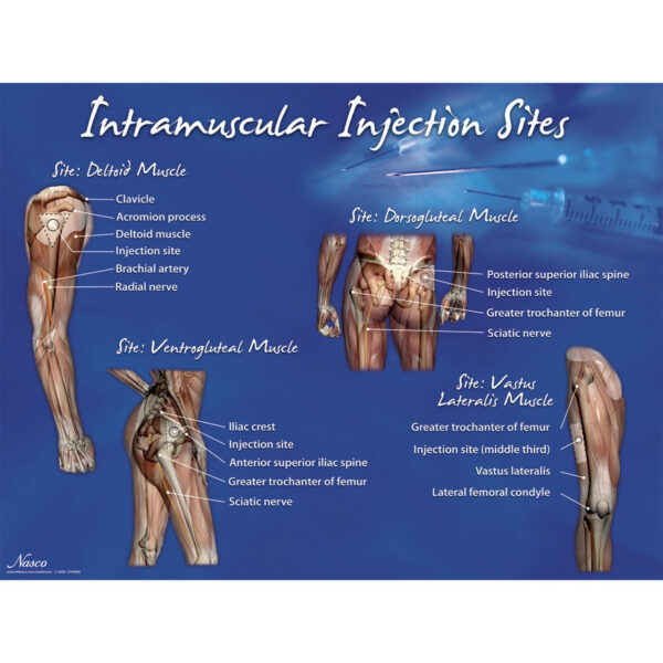 Nasco Intramuscular Injection Sites Poster