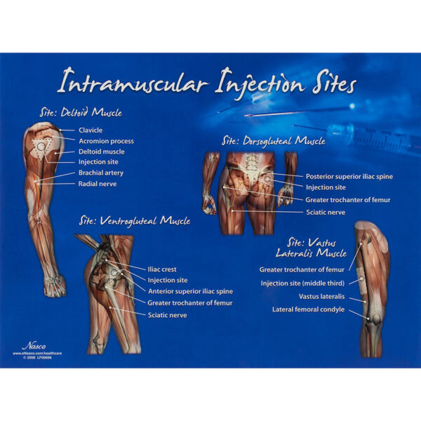 Nasco Intramuscular Injection Sites Chart