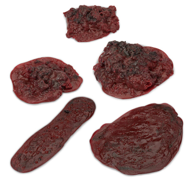 Nasco Life/form® Clots and Hemorrhages - Set of 5 [SKU: LF00714]