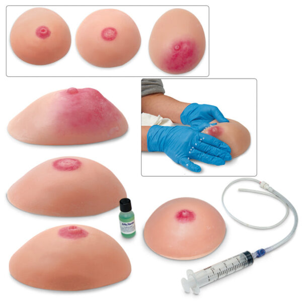 Nasco Life form Common Breast Conditions Replicas Set of 4 [SKU: LF00864]