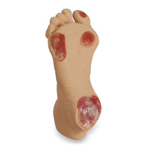 Nasco Life form Light Elderly Pressure Ulcer Foot [SKU: LF00933]