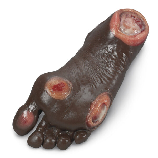 Nasco Life form Elderly Pressure Ulcer Foot Dark [SKU: LF00944]