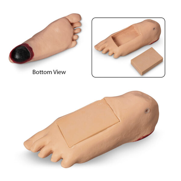 Nasco Life form GERi and KERi Optional Edema Foot with Deep Tissue Injury Light