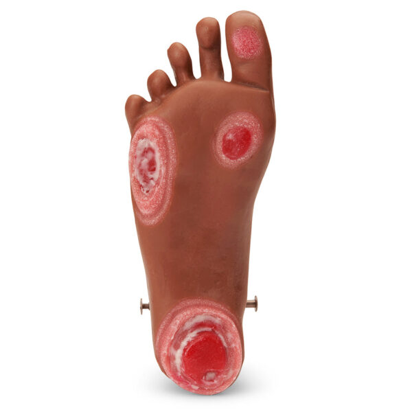 Nasco Life form GERi KERi Optional Pressure Injury Foot Medium [SKU: LF04128]