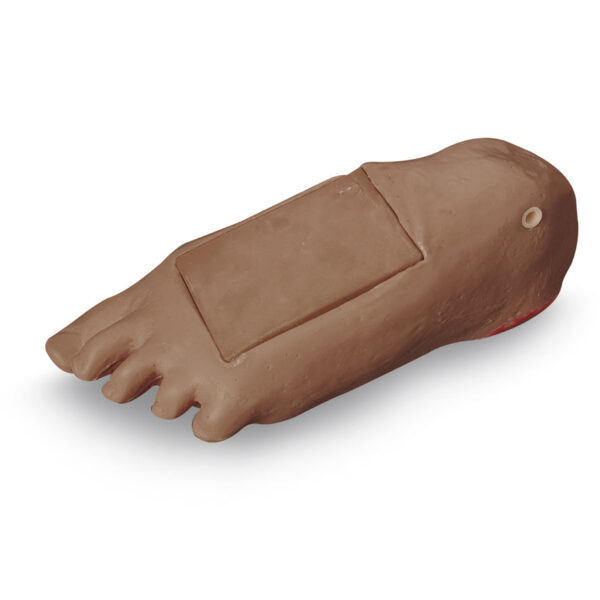 Nasco Life form GERi KERi Optional Edema Foot with Deep Tissue Injury Medium