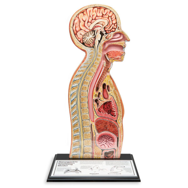 Nasco Nasogastric Tube Feeding Model [SKU: SB10239]