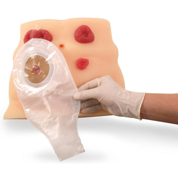 Nasco Ostomy Care Model