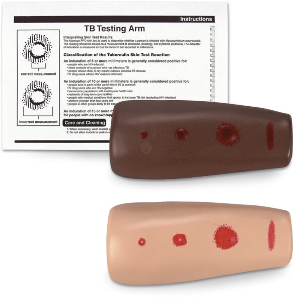 Nasco TB Testing Arm