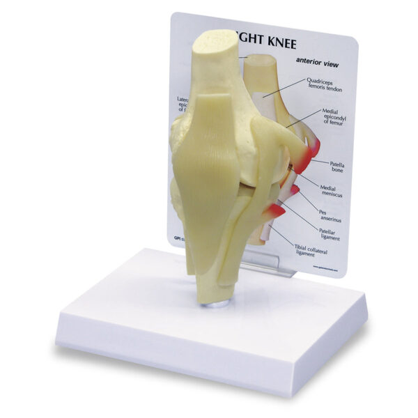 Nasco Basic Knee [SKU: SB35430]