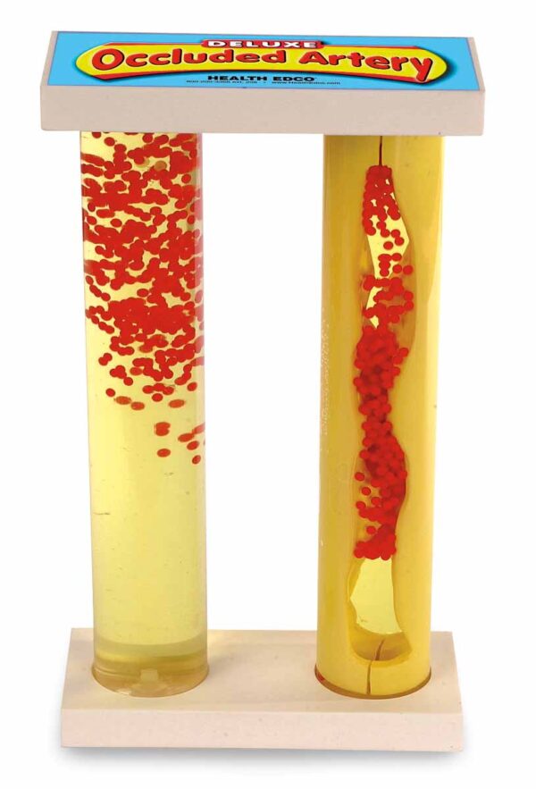 Nasco Deluxe Occluded Artery Model [SKU: SB43034]