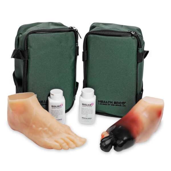 Nasco Diabetic Foot Model Set