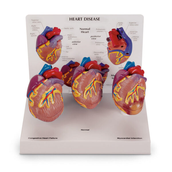 Nasco 3 Piece Mini Heart Set Models [SKU: SB44893]