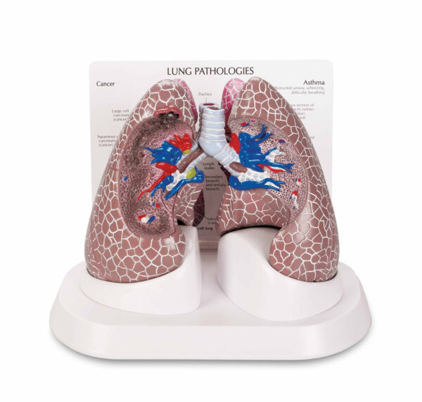 Nasco Lung Set with Pathologies [SKU: SB44894]