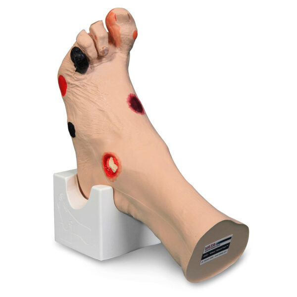 Nasco Wilma Wound Foot [SKU: SB46503]