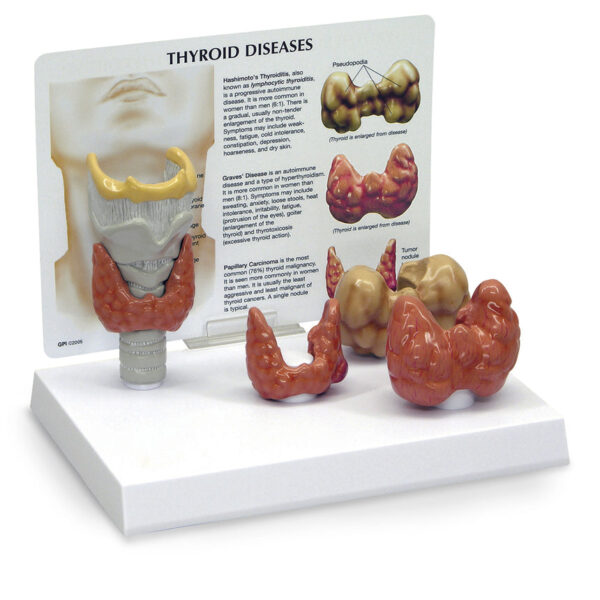 Nasco Thyroid Model