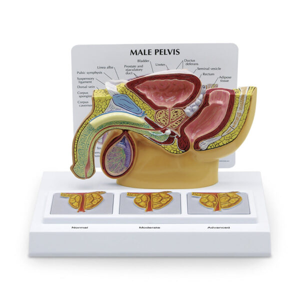 Nasco Male Pelvis with Prostate and BPH