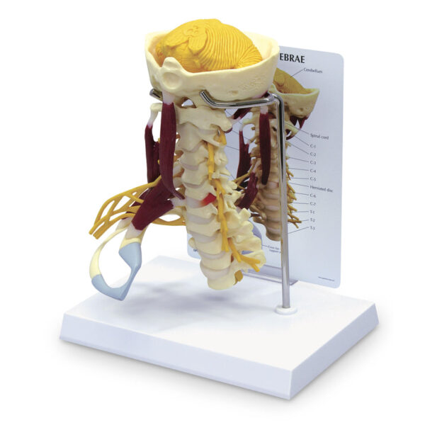 Nasco Life Size Cervical Model with Muscles and Nerves