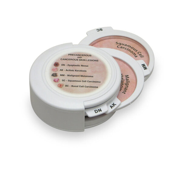 Nasco 5 Piece Hinged Skin Cancer Disk Set