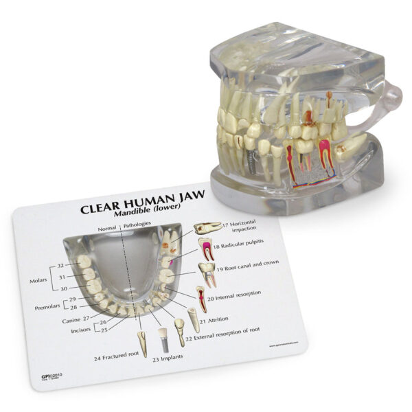 Nasco Clear Human Jaw with Teeth