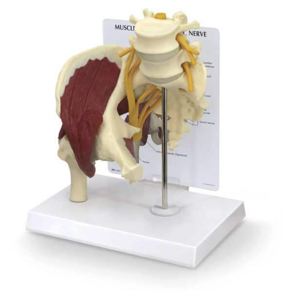 Nasco Muscled Hip with Sciatic Nerve Model