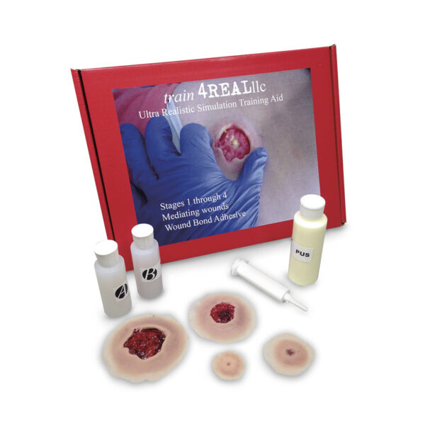 Nasco Pressure Ulcer Simulation Training Kit Light