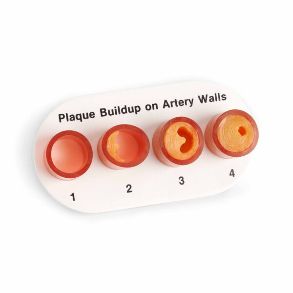 Nasco Artery Sections with Blockage [SKU: WA09742]